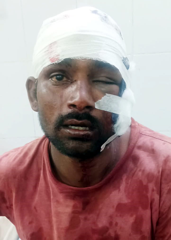 बाह: बाह में राम बाग के रवी का ईंटों से कूंचा सिर और मुंह