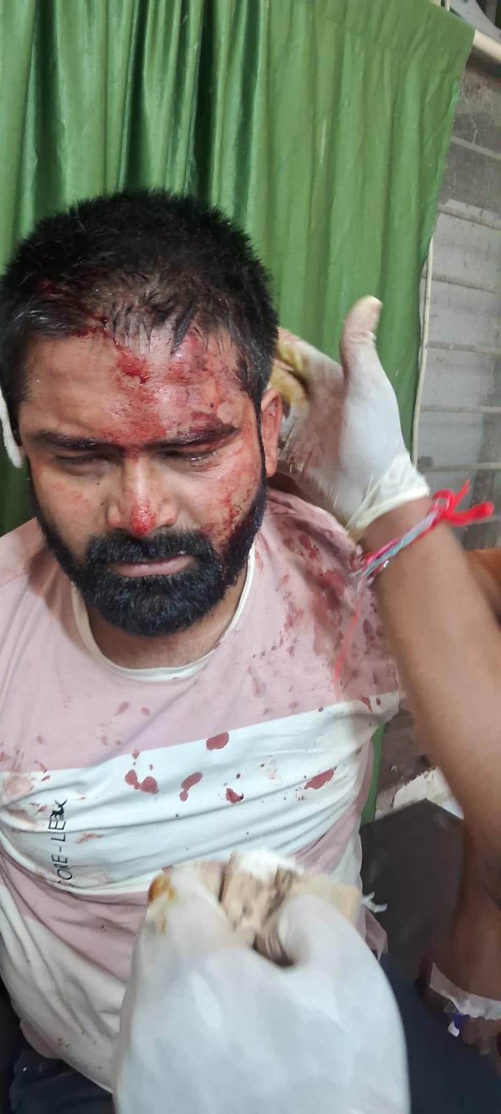 Youth and two friends attacked, police accused of pressuring to alter the complaint