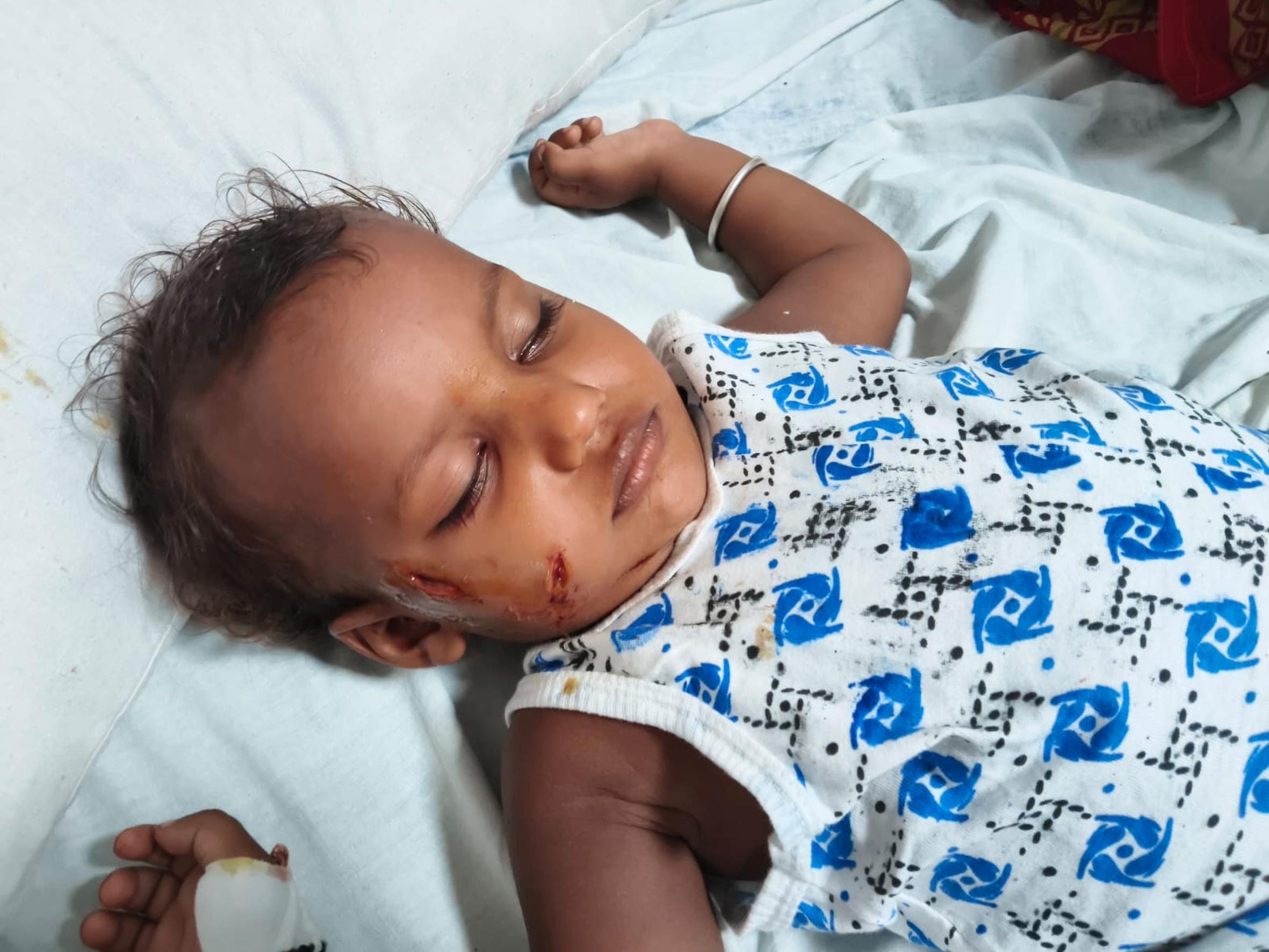कुत्ते के हमले में घायल संस्कार।