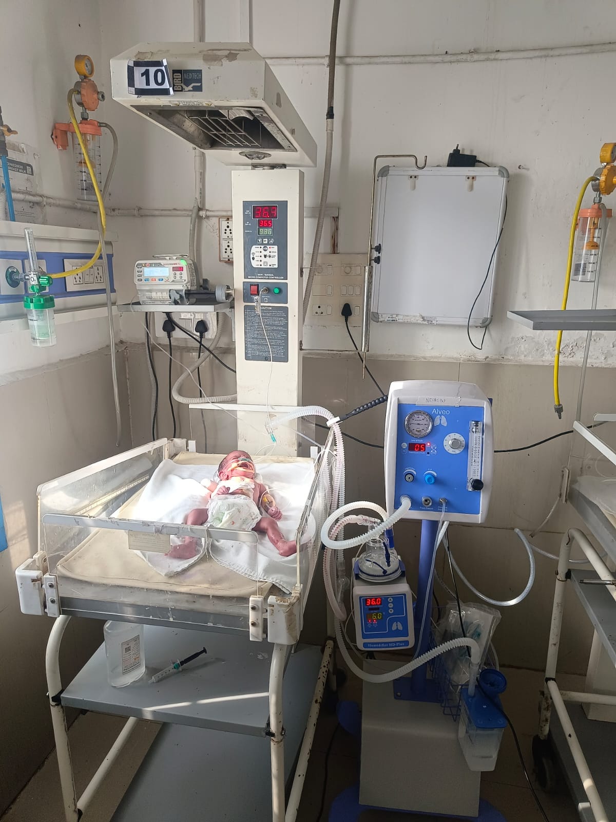Two CPAP machines will shield children in respiratory distress