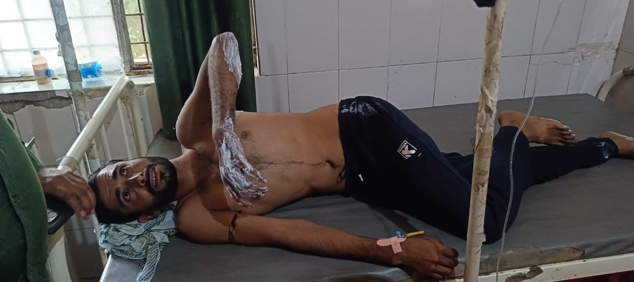 Contract lineman went to work on high tension line without any information, got burnt