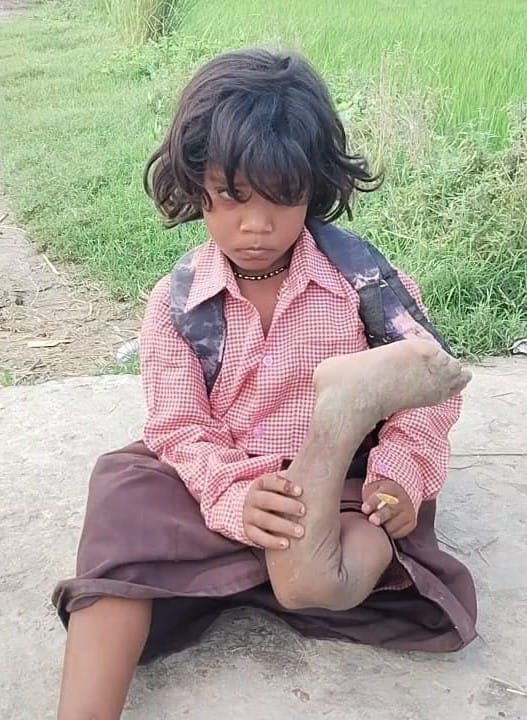मनियर क्षेत्र के रानीपुर निवासी रागिनी।