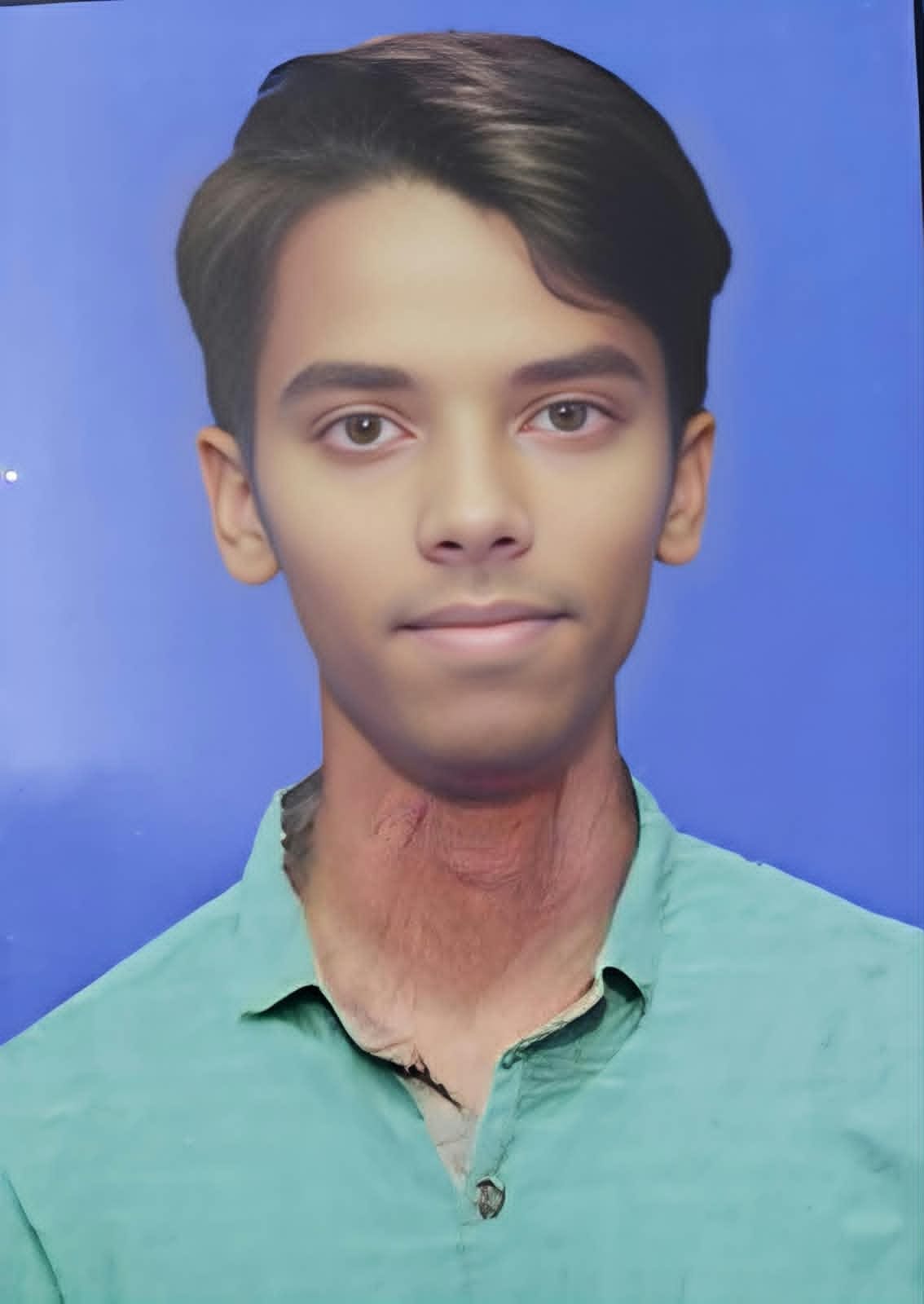 Abhishek will see the world even after death.