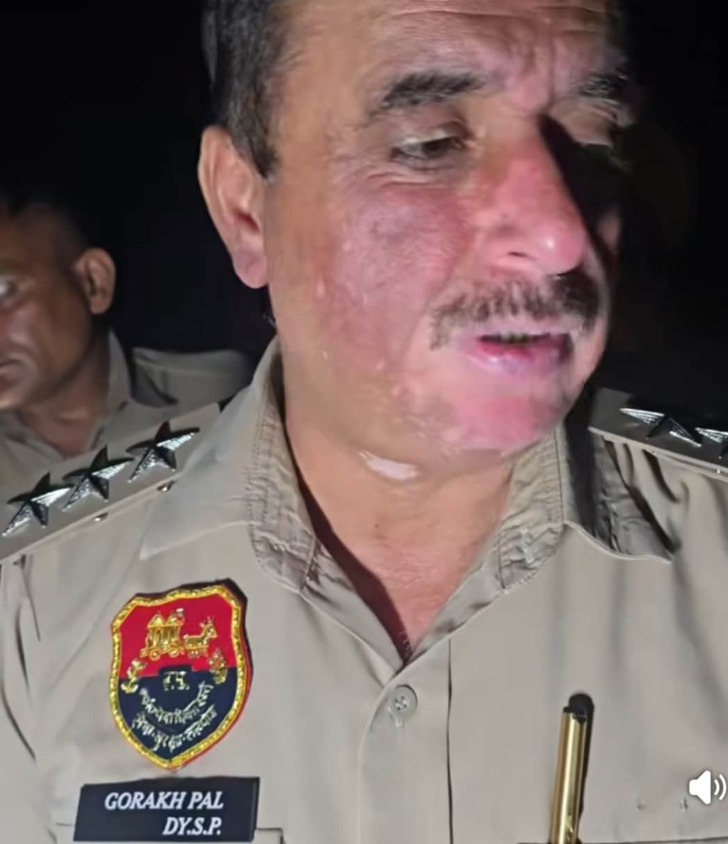 Encounter between police and criminals on canal bank in Asandh; bullet hits leg.