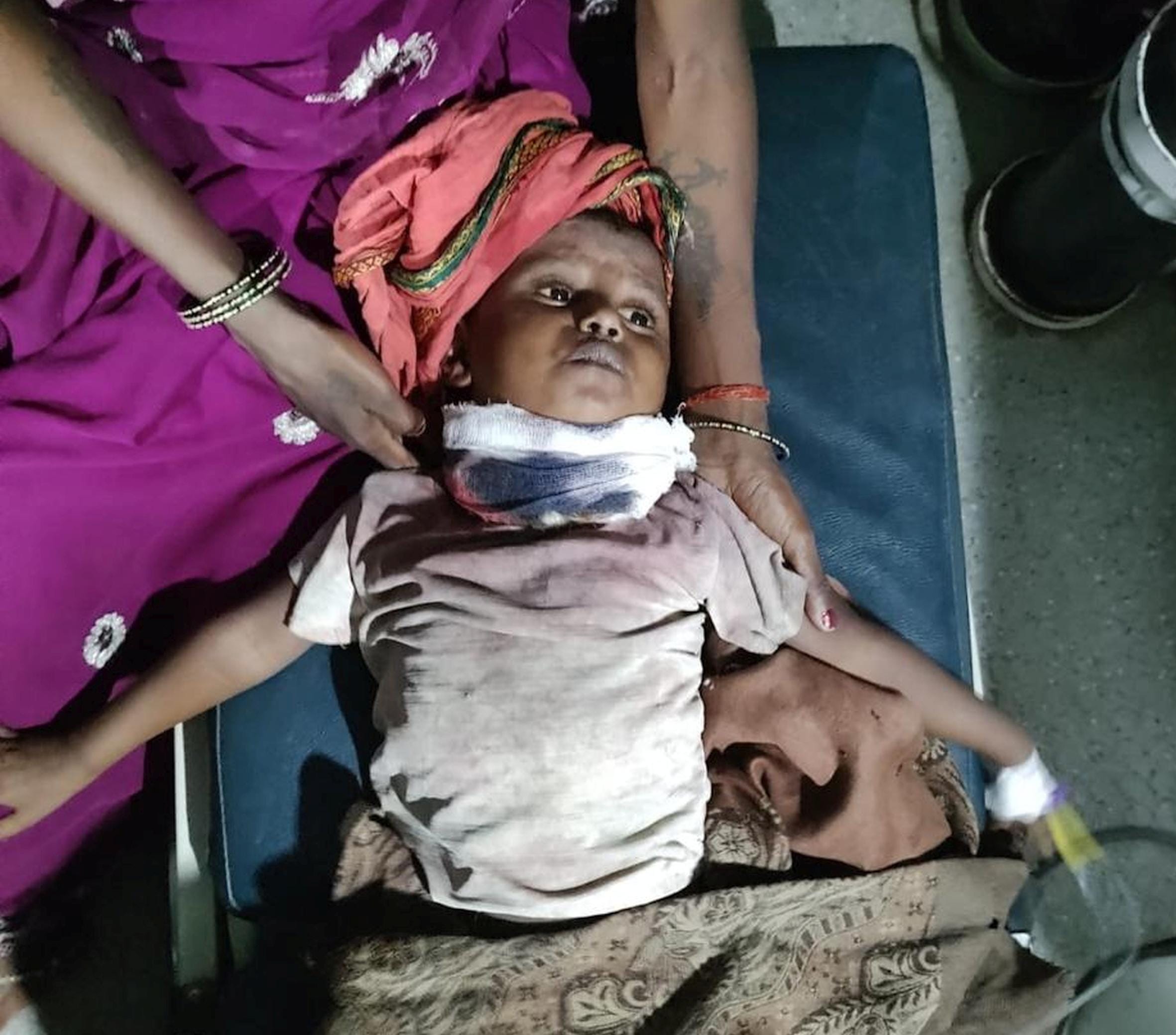 तेंदुए के हमले में घायल बालिका लाडो।