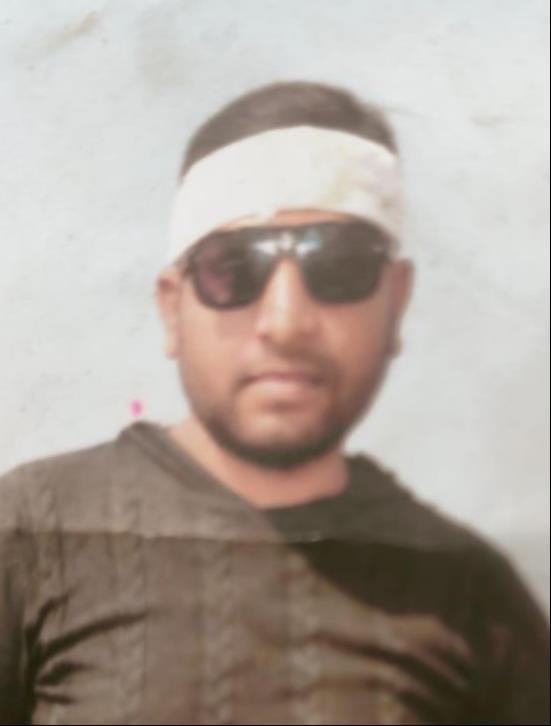 Painter dies from electric shock, FIR filed against the landlord