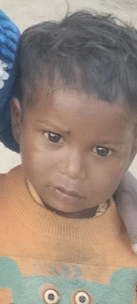 Four-year-old child dies after being bitten by a venomous insect.