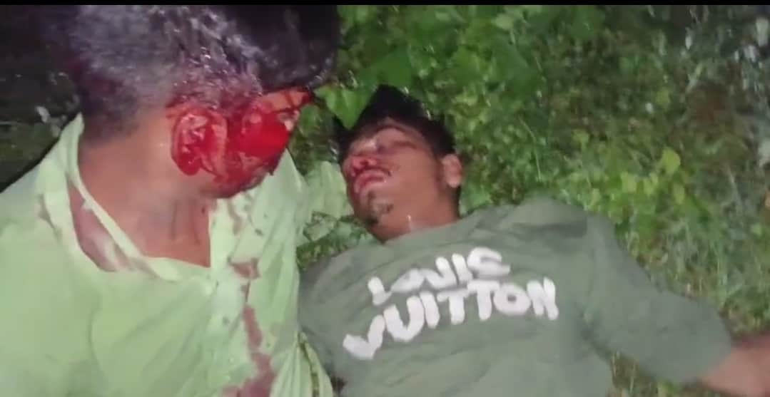 भीटी के पास नीलगाय से टकराने से घायल युवक। संवाद