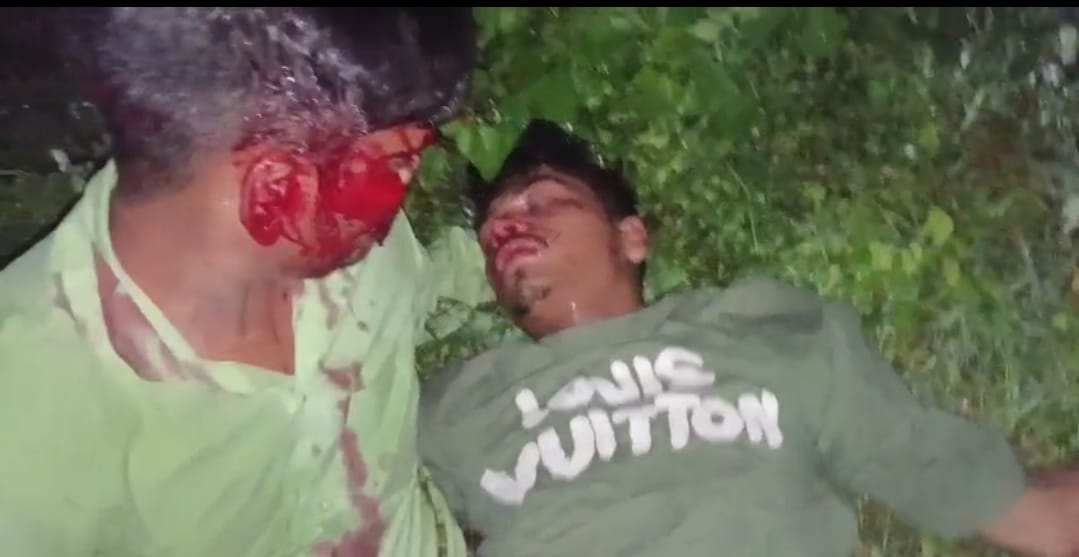 भीटी के पास नीलगाय से टकराने से घायल युवक। संवाद