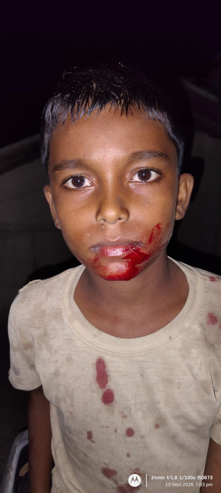 तेंदुओं के हमले में घायल बालक व महिला।