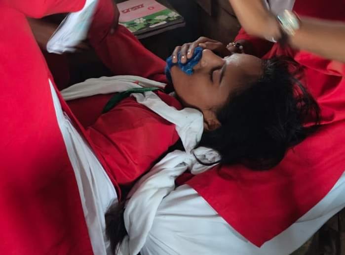 A fan fell during class, injuring three students.