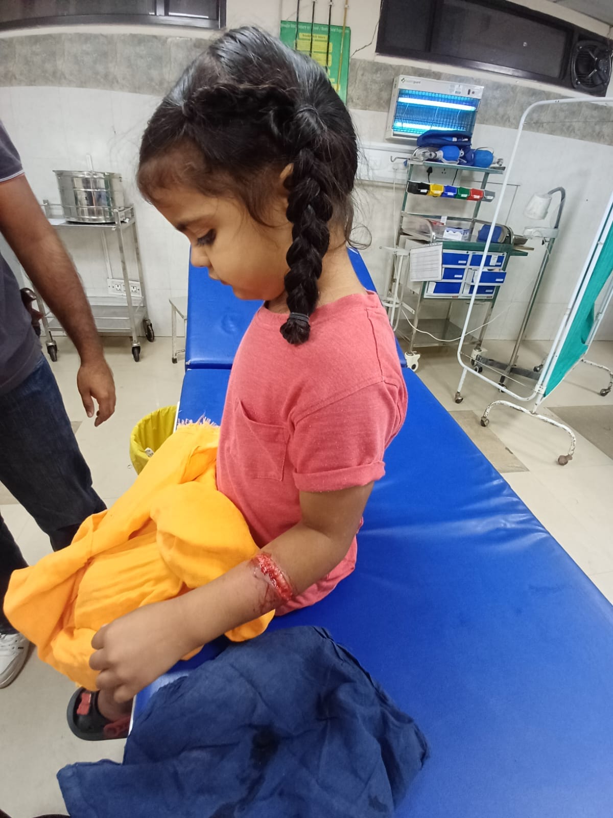 A dog bites a girl playing outside her home, leaving a deep wound on her hand.