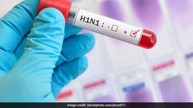 Swine flu confirmed in young woman; admitted in Agra.