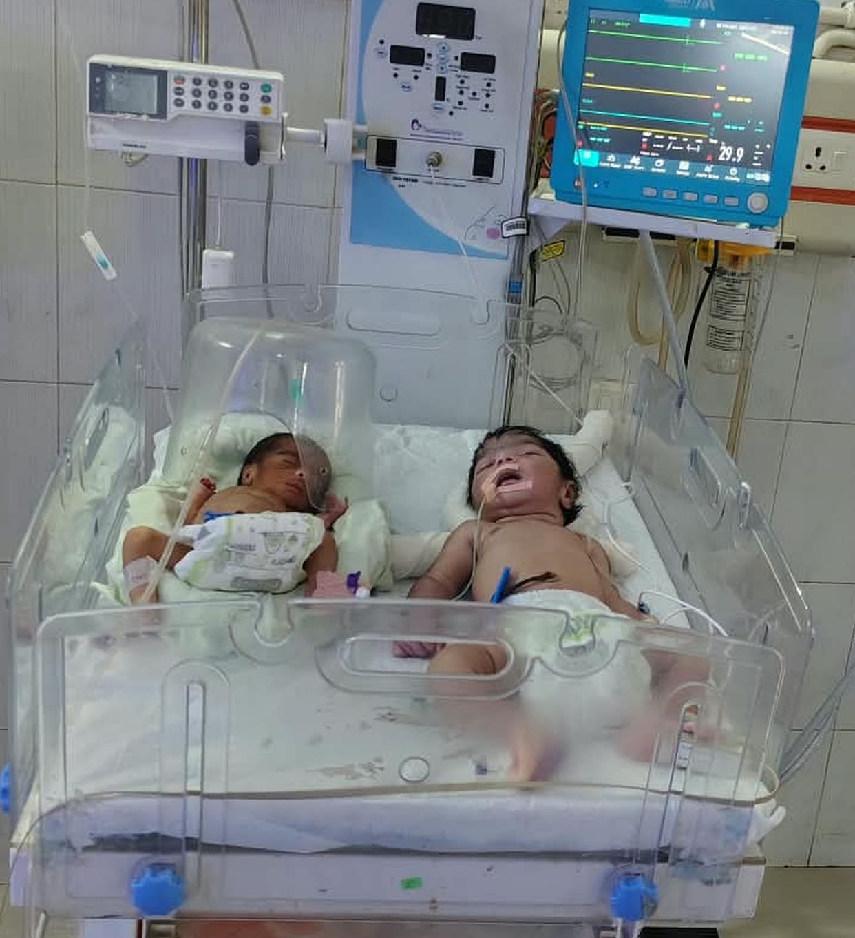 22 newborns in 12 warmers; two babies being treated in one