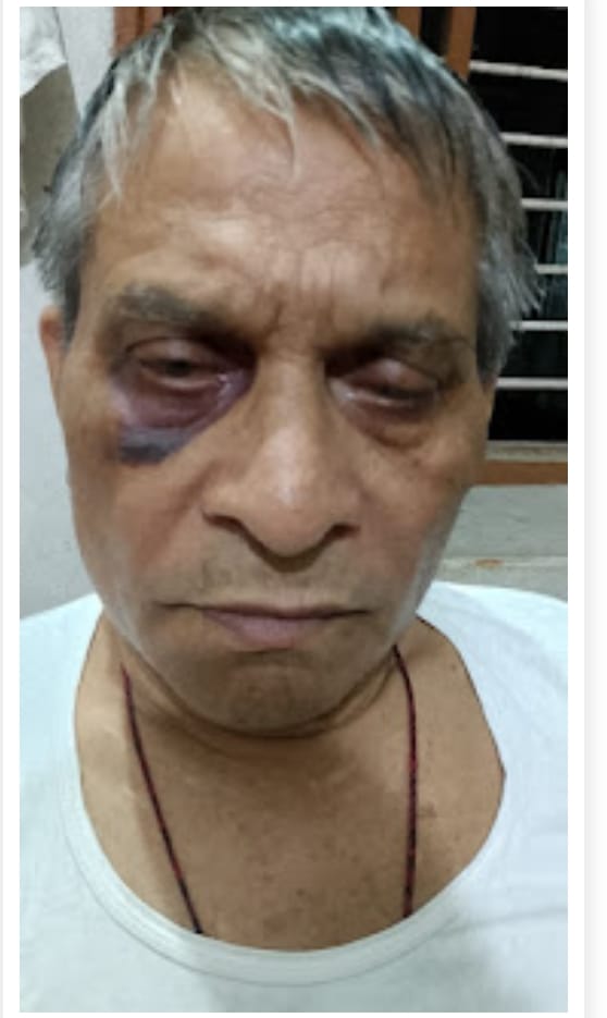 घायल हालत में माध्यमिक शिक्षा चयन आयोग उत्तर प्रदेश के पूर्व चेयरमैन प्रो. डा. आशाराम। सोशल मीड