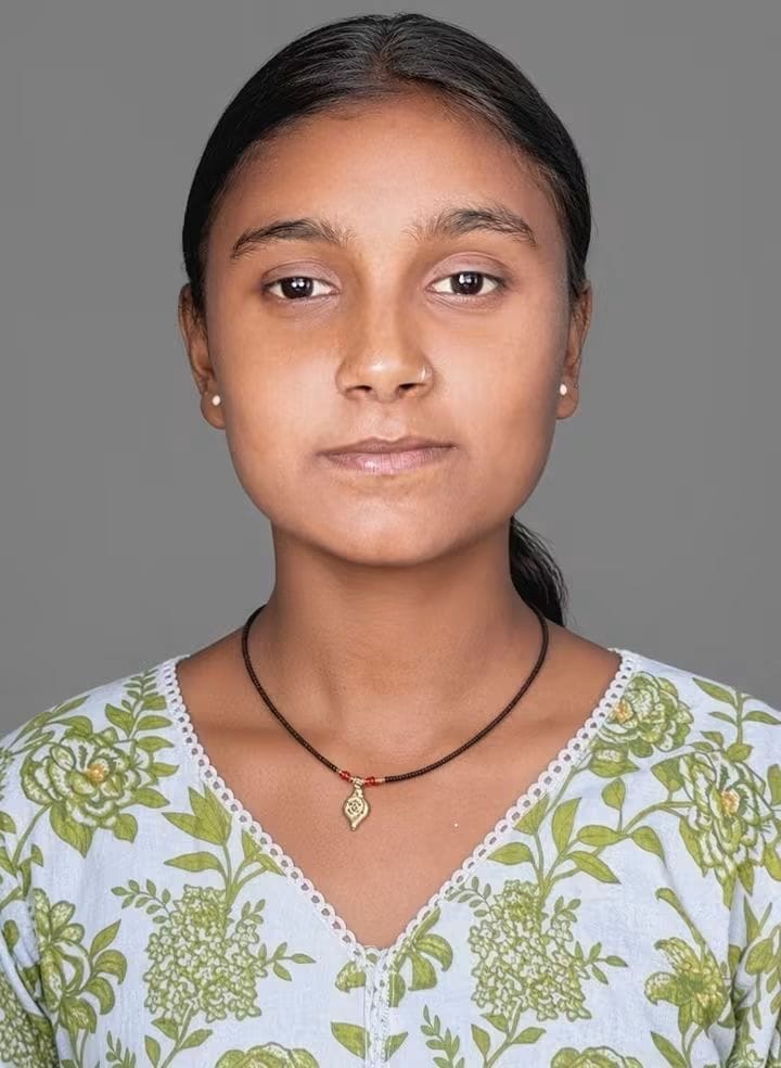 Teenage girl with burn injuries succumbs during treatment.