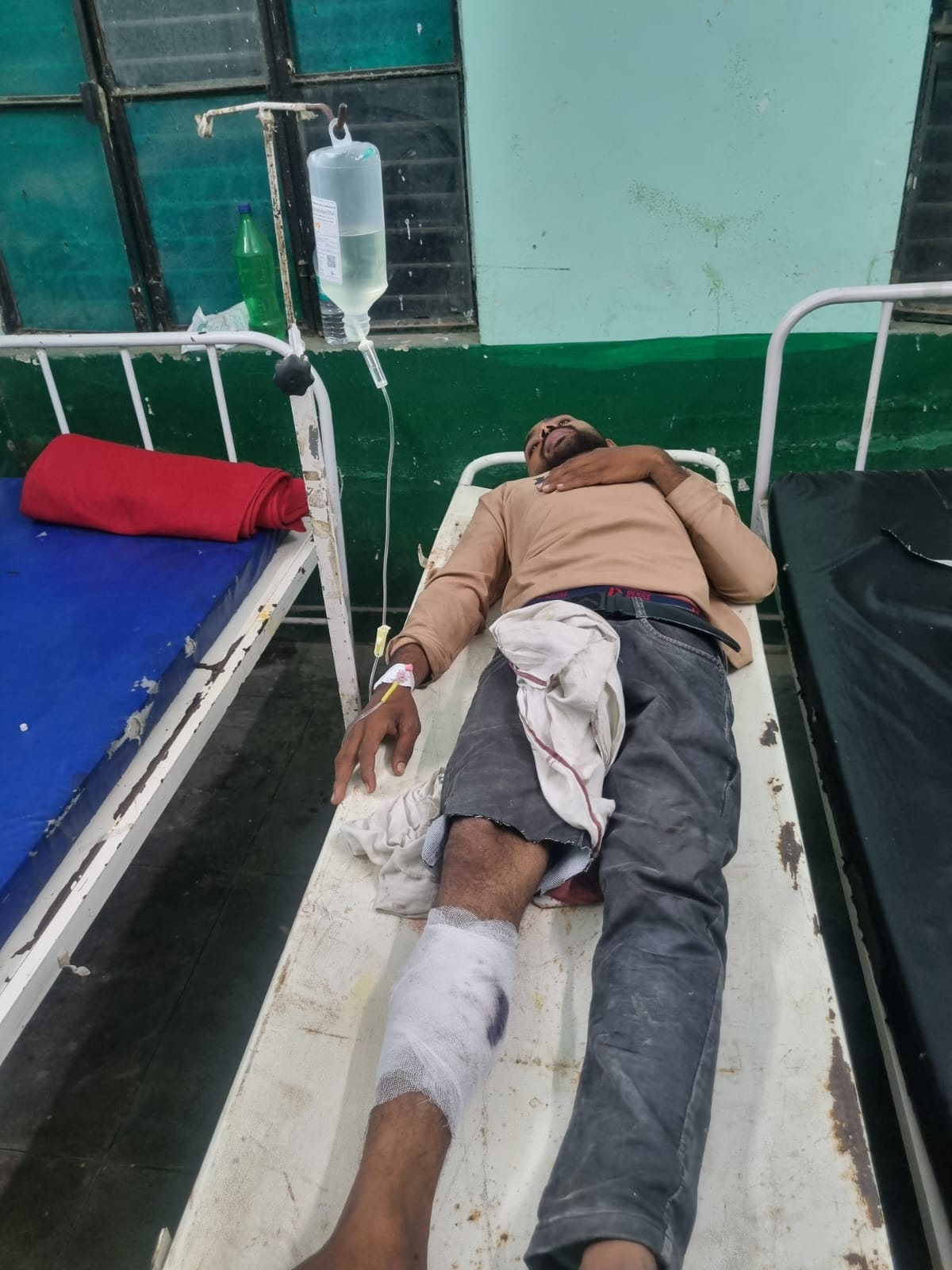 मुठभेड़ के दौरान गोली लगने से घायल आरोपी। स्रोत: सोशल मीडिया
