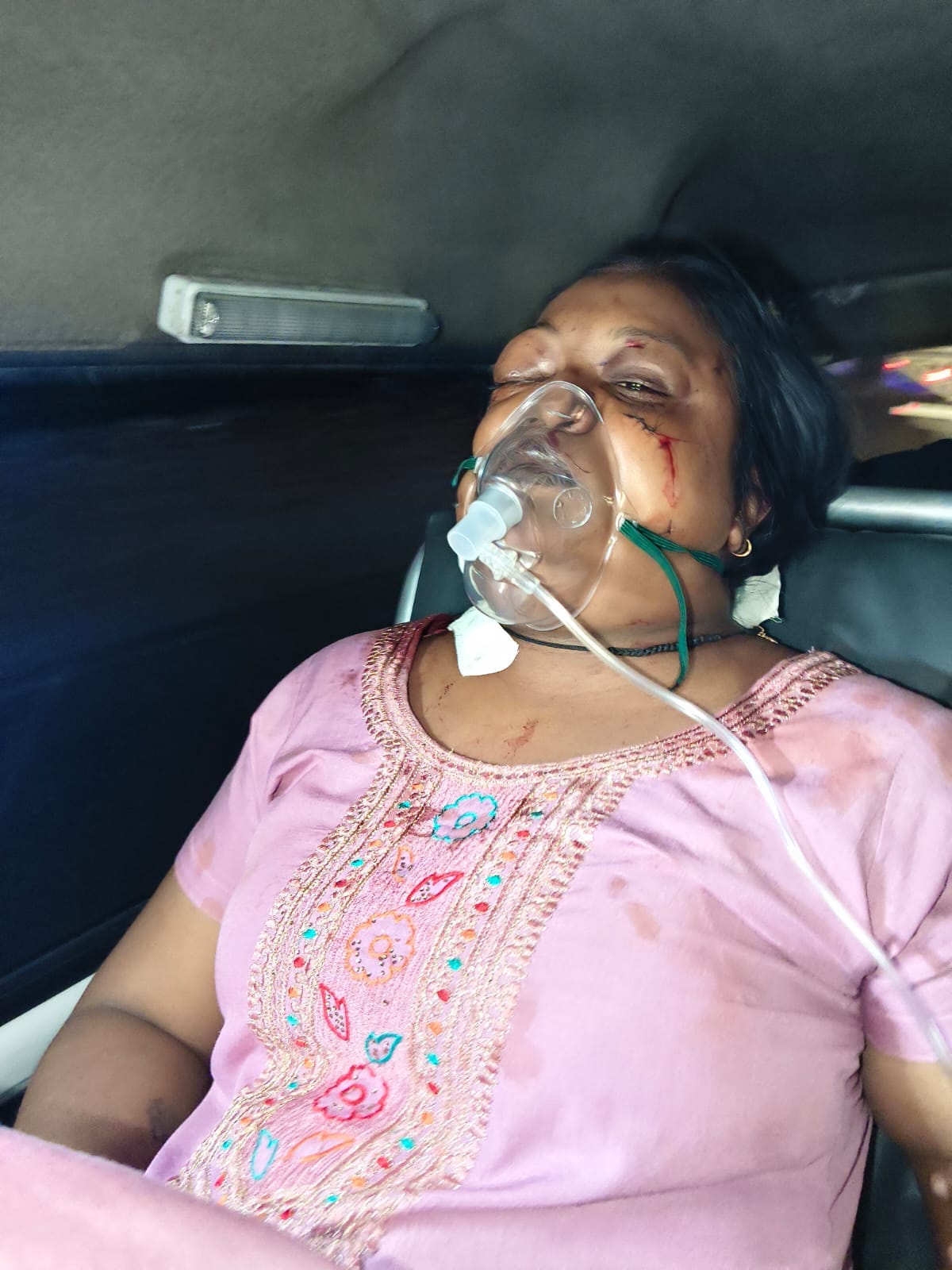 हमले में घायल