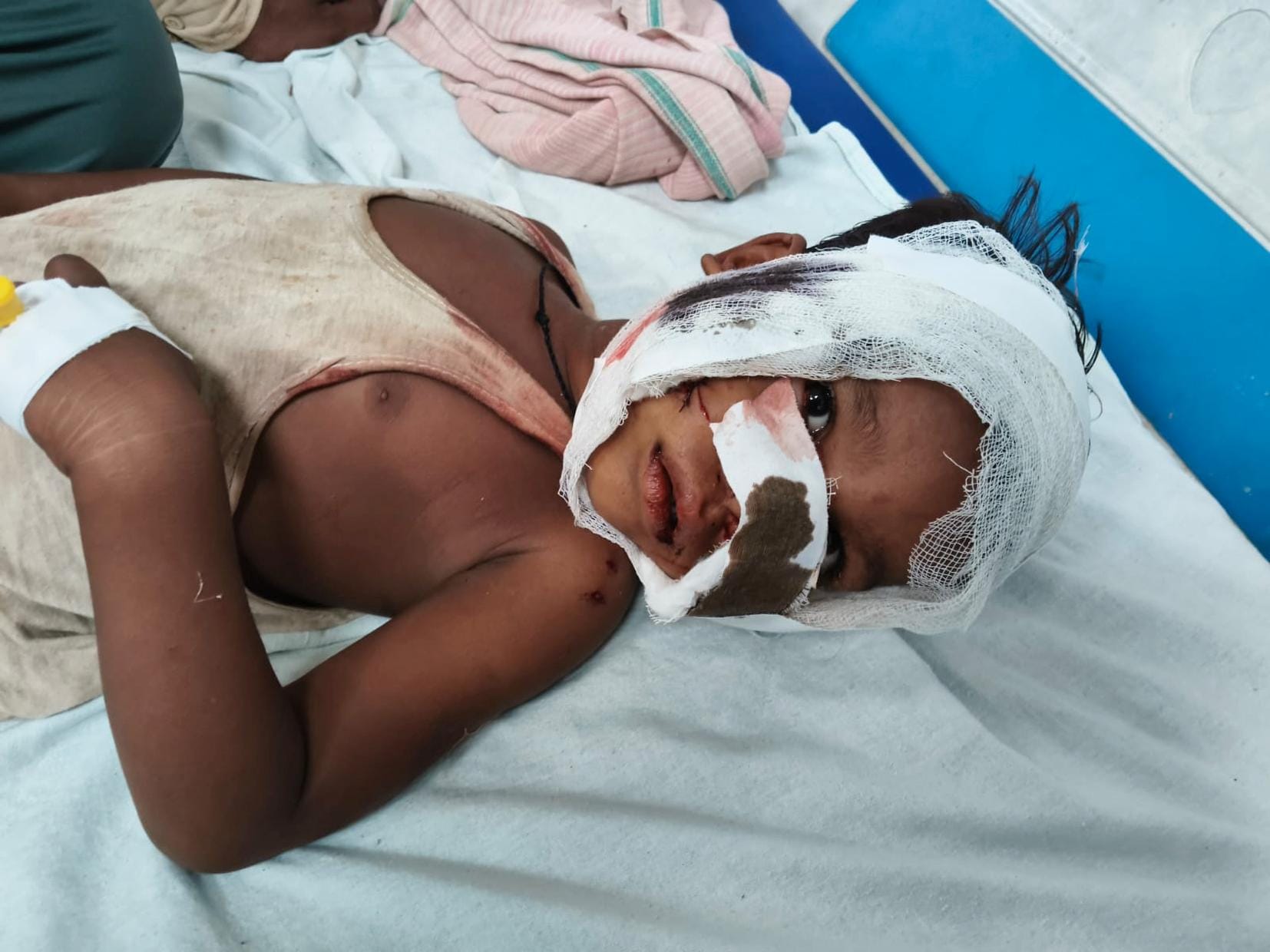 कुत्ते के हमले में घायल संचित।