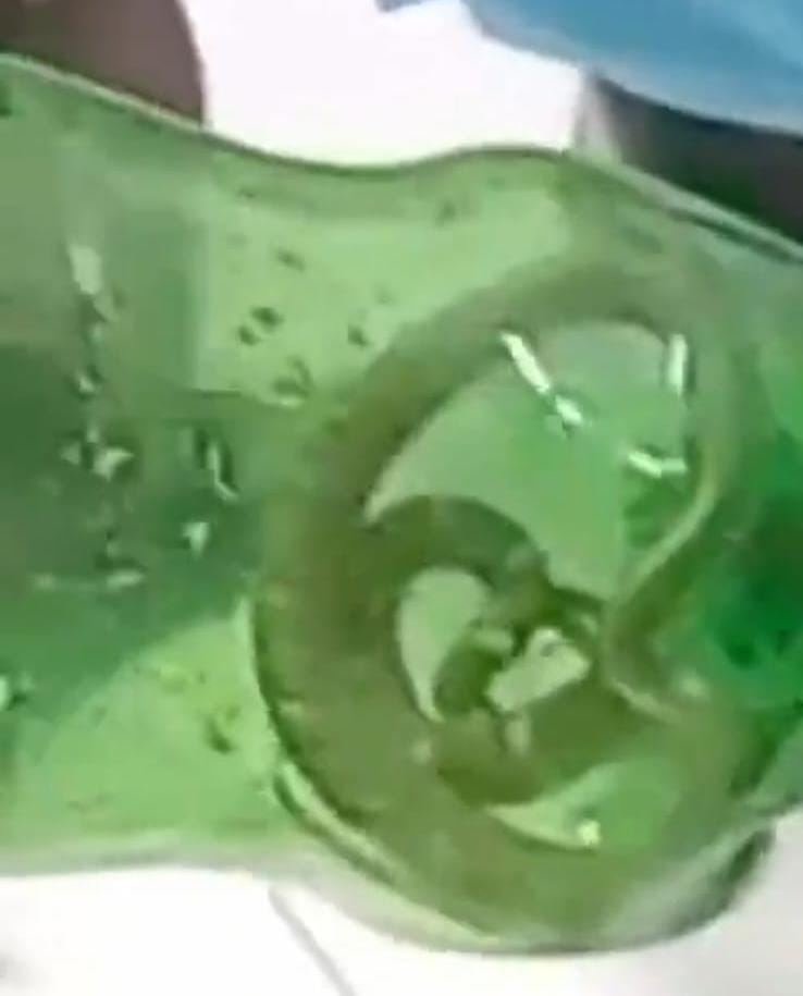 जिला अस्पताल में लाया गया बोतल में बंद सांप । वीडियोग्रैब