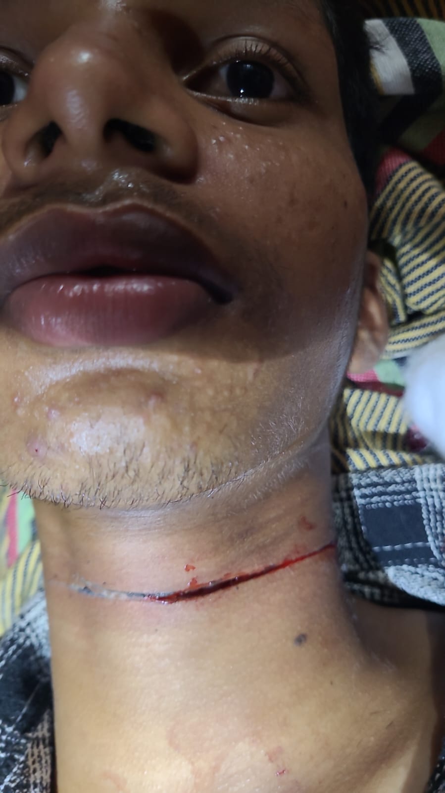 Teenager injured in the neck after getting caught in banned kite string