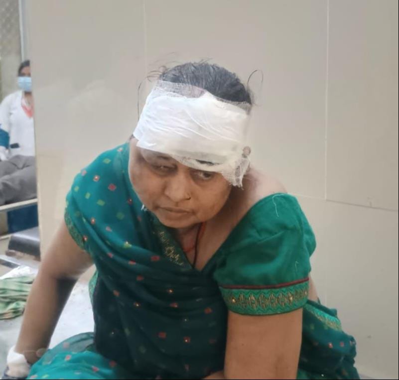 3 laborers injured after being hit by a vehicle; two in critical condition.