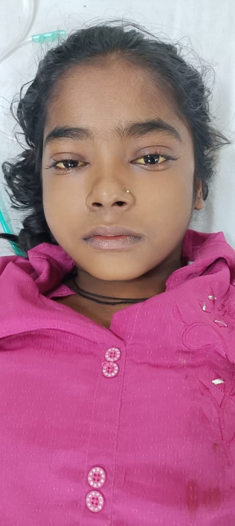 Student suffering from jaundice dies