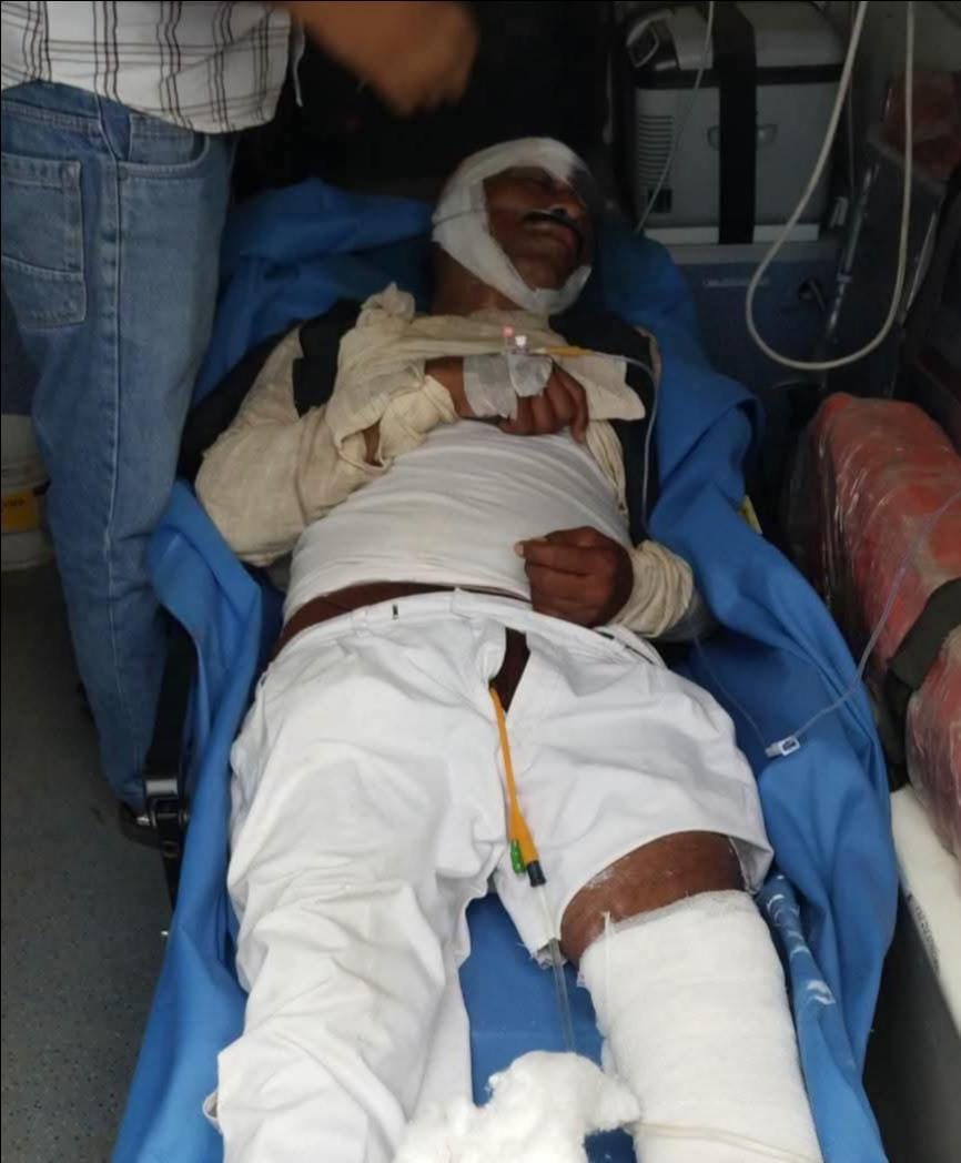 Car hits BJP leader on his way to a felicitation ceremony; referred to Varanasi.