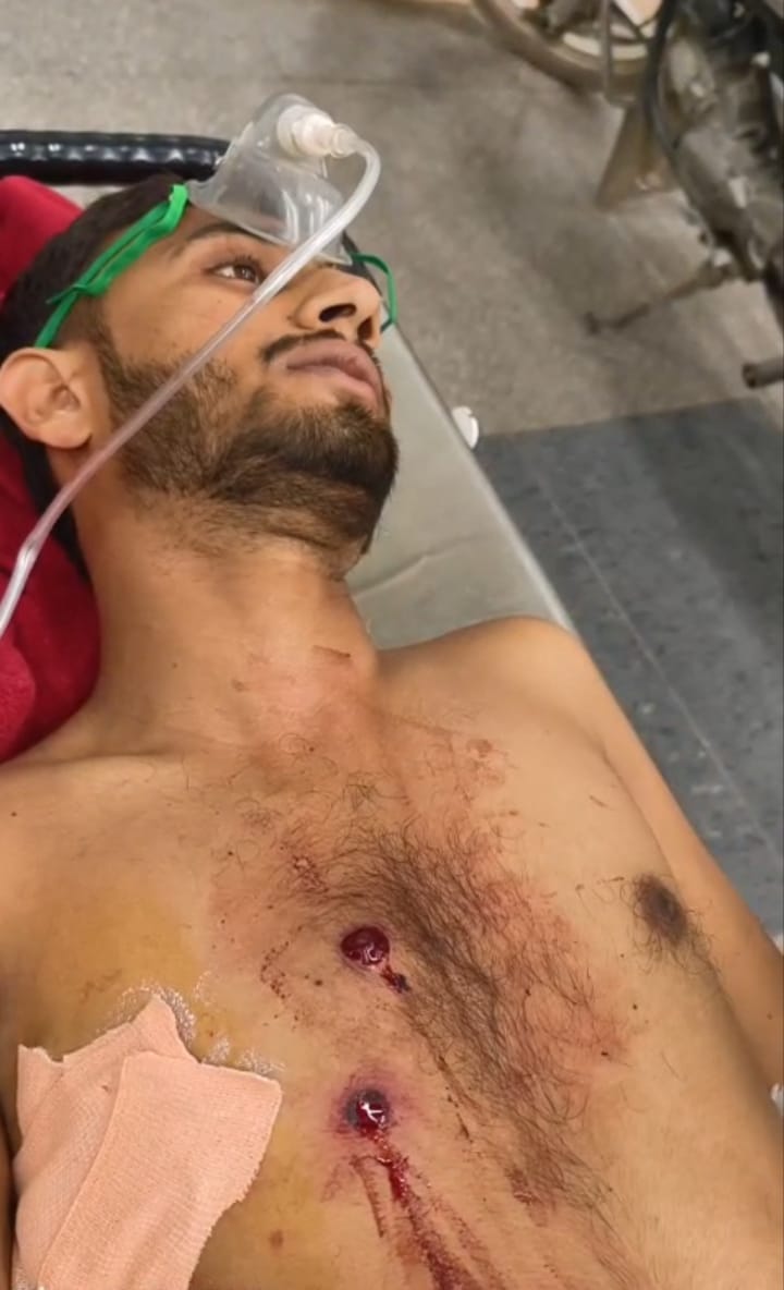 Indiscriminate firing outside the house; youth shot in the chest.