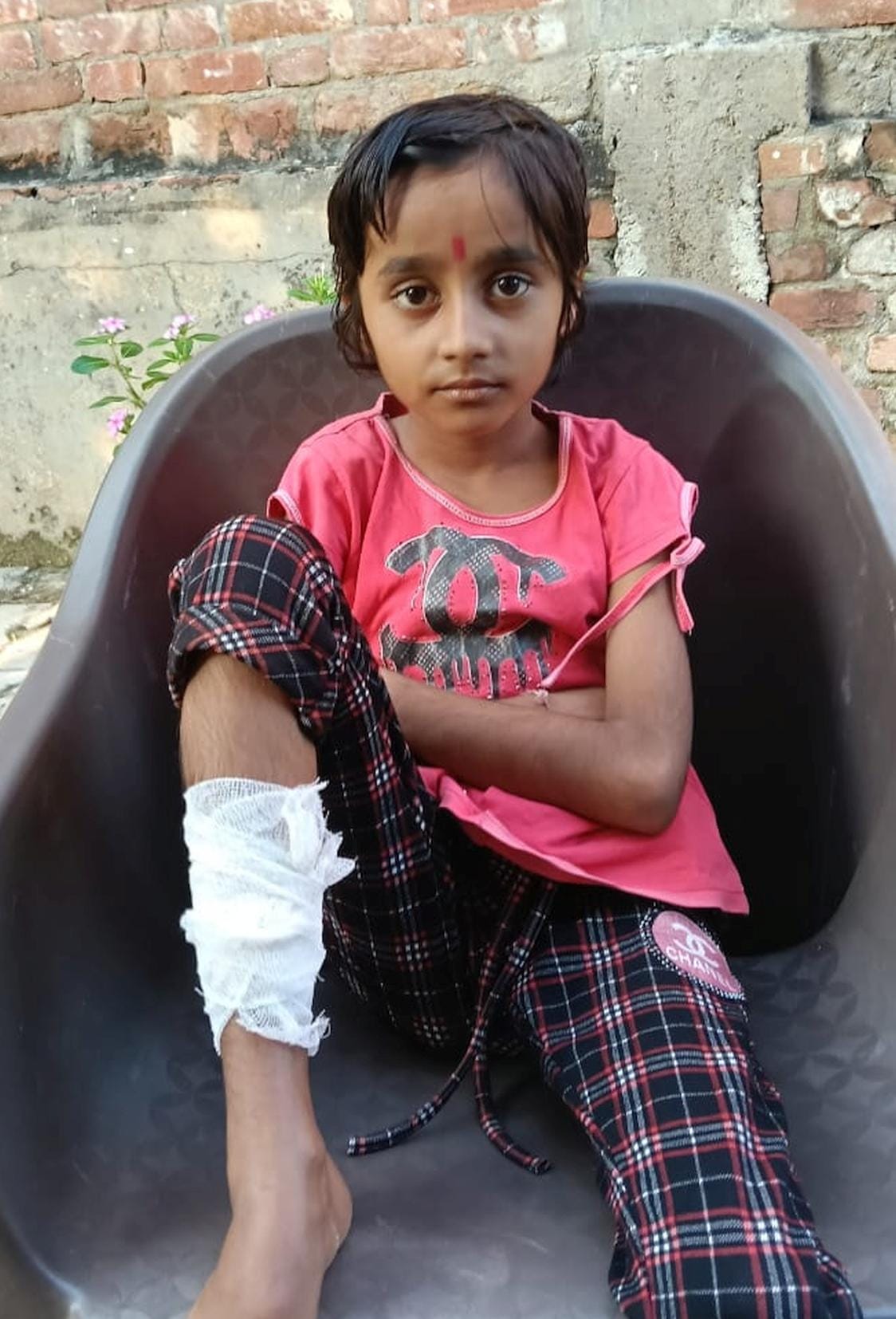 Monkey enters house and attacks girl; she is injured.