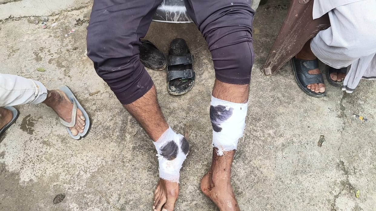 Youth injured after getting entangled in power lines; villagers protest against bio-energy plant.