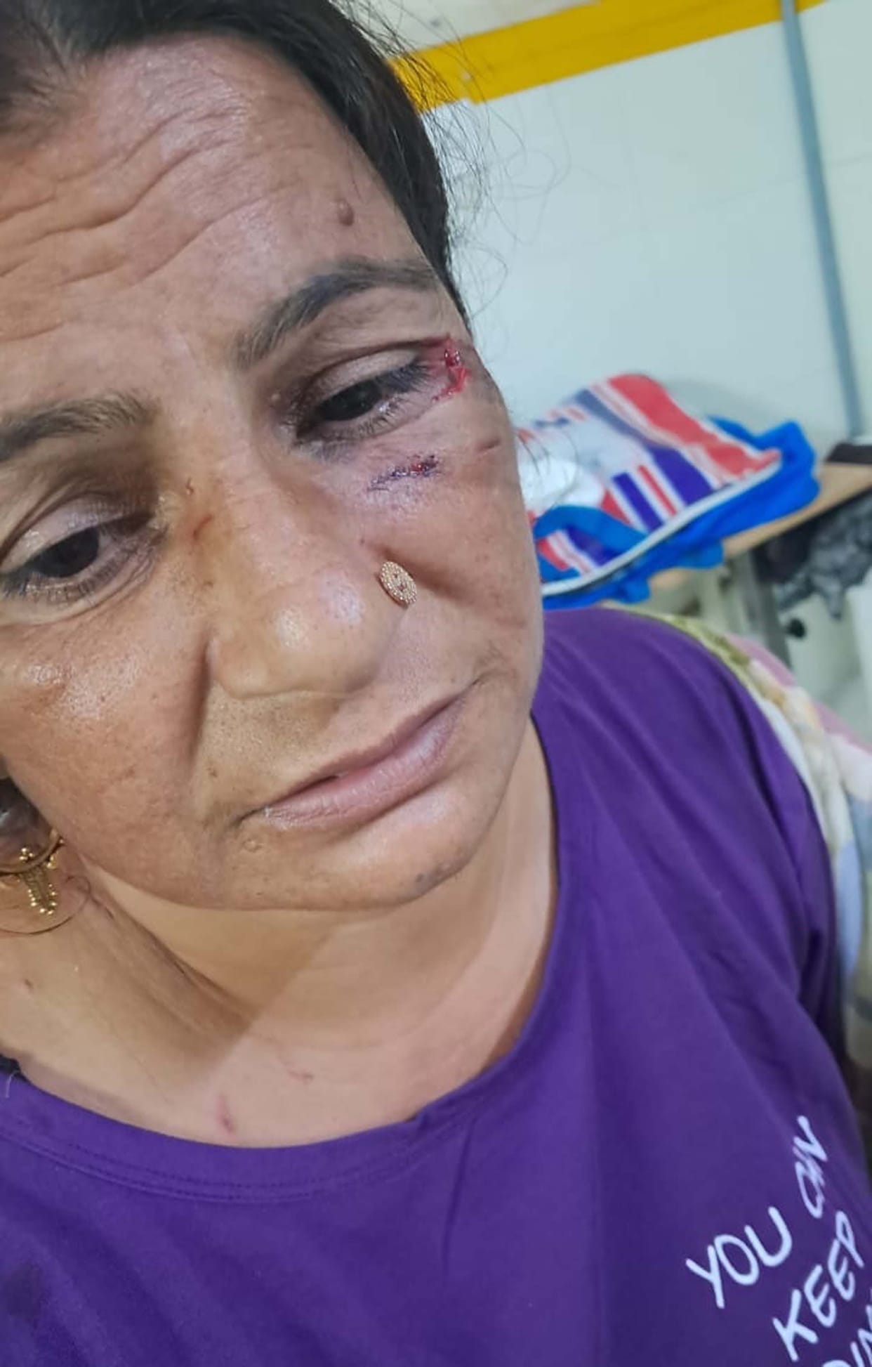 Stray dogs attack a woman