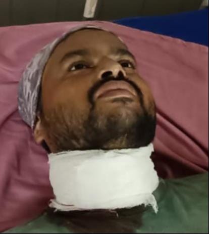 A biker's neck was cut by banned glass-coated string, needed several stitches