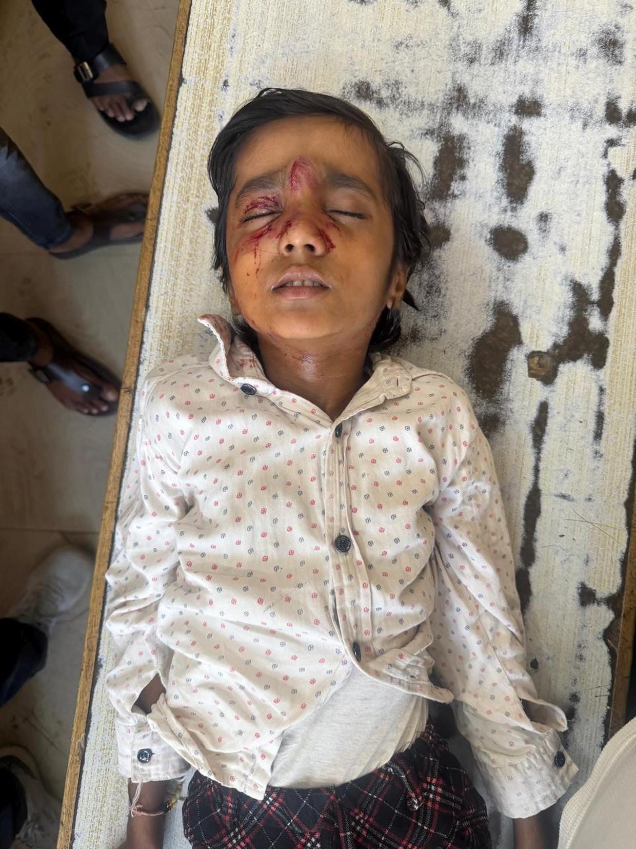 Monkey chases girl, enters house and attacks again.