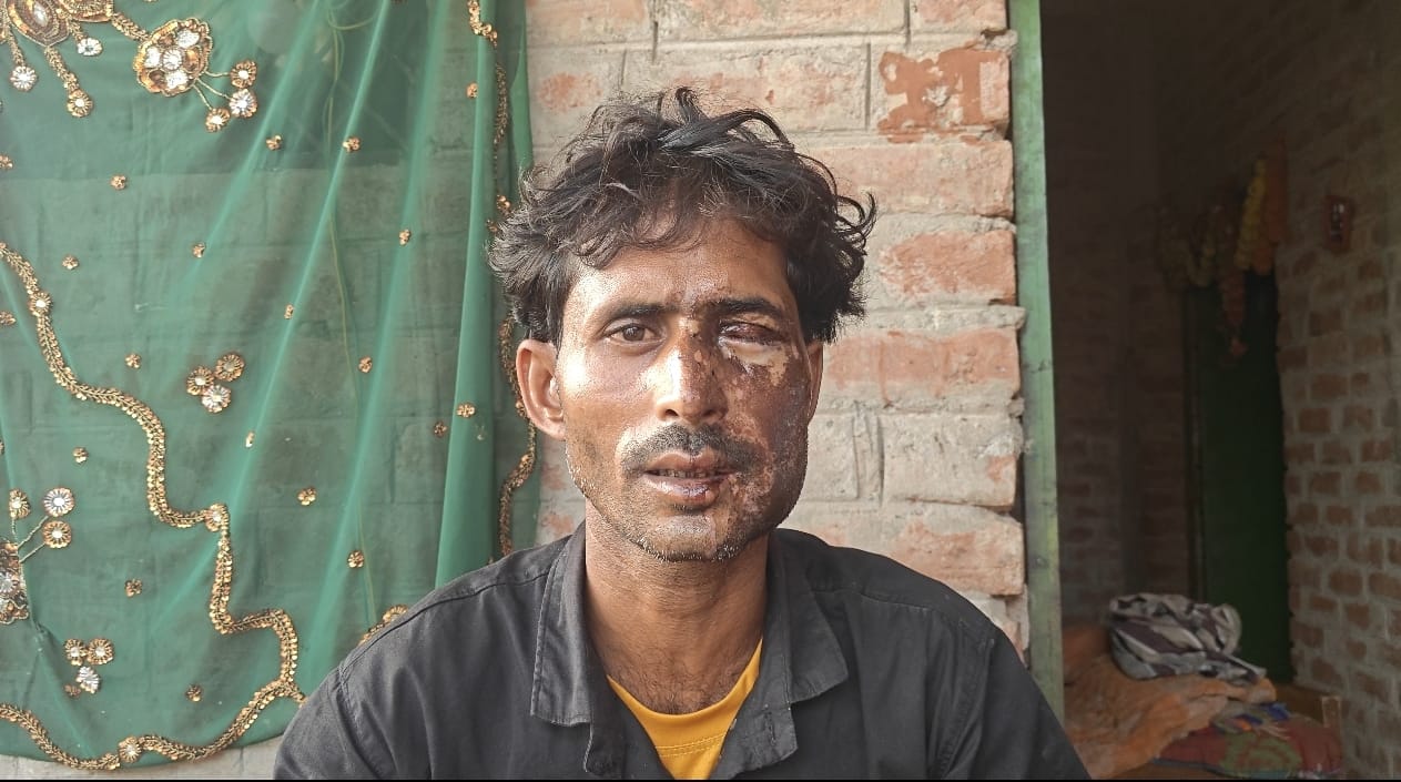 पीड़ित उमेश।
