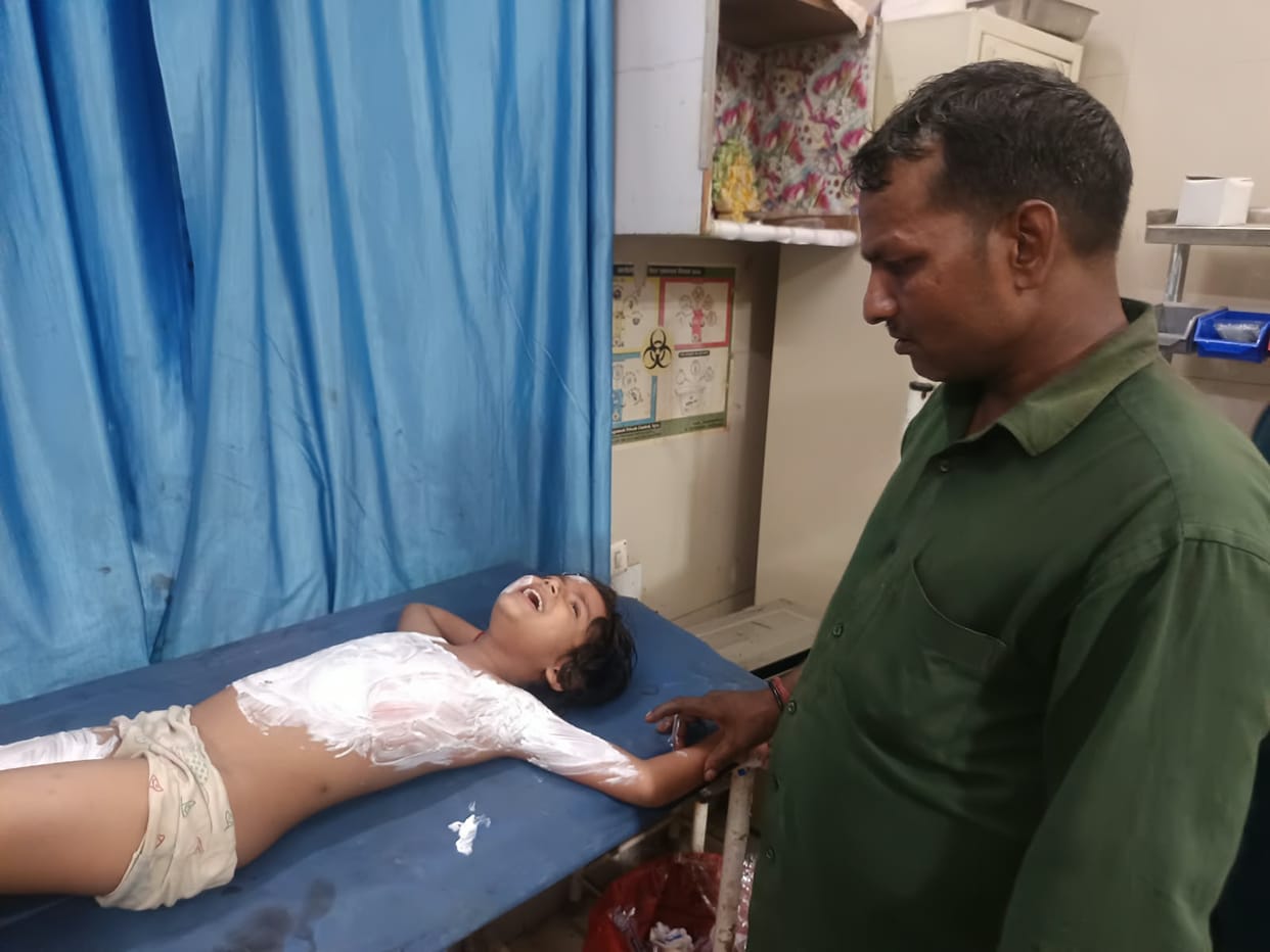 Six-year-old girl scalded by spilled hot milk; admitted to trauma center.