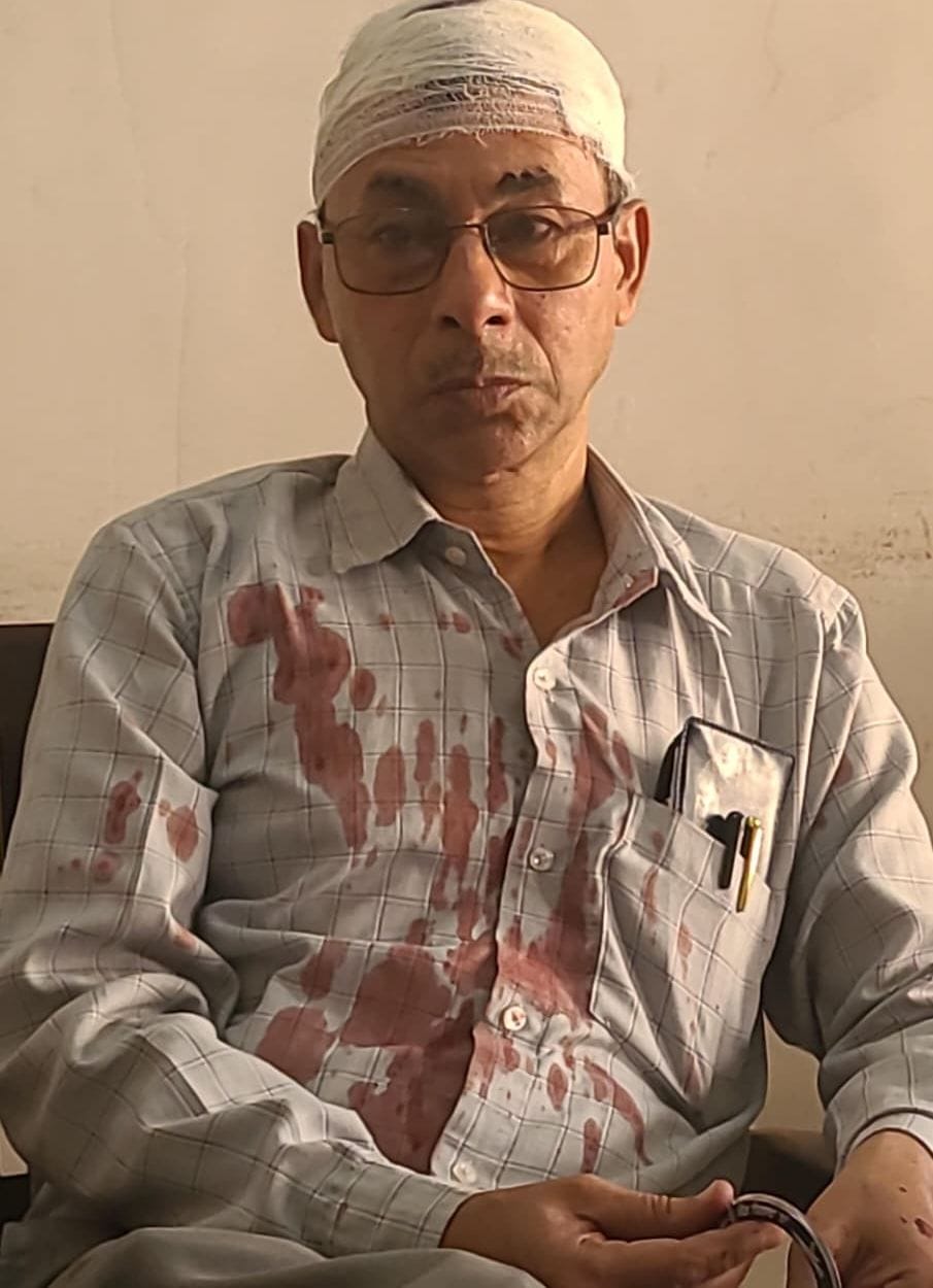 Student attacks and bloodies teacher after being scolded in class.