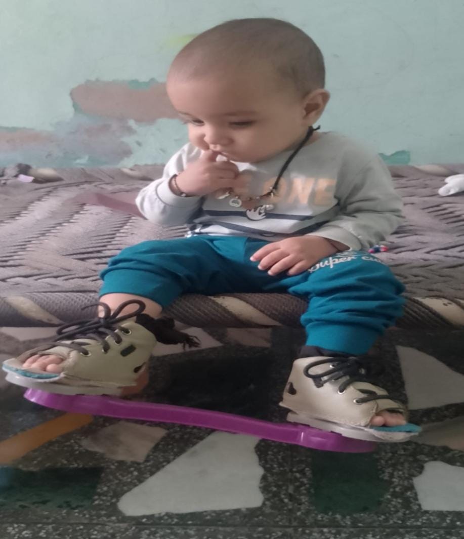 RBSK gives two children a new lease on life; free treatment transforms their lives.