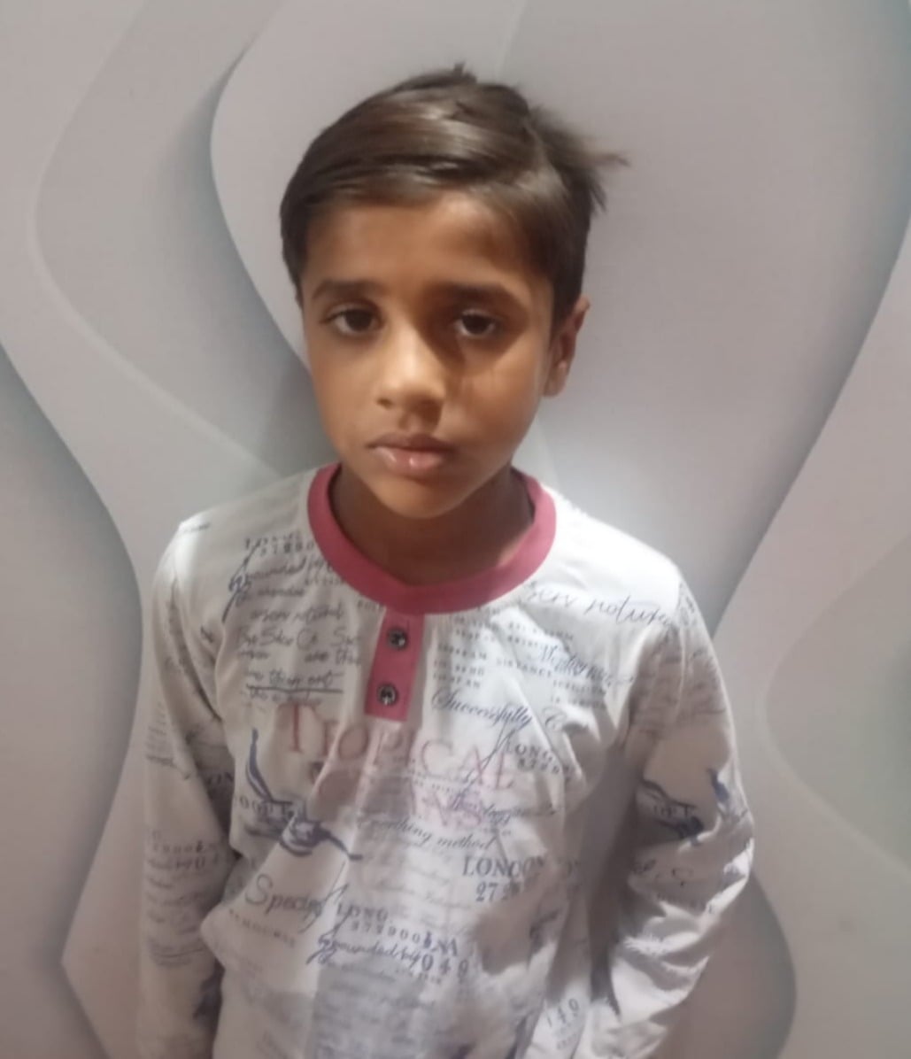 Meerut News: झिटकरी में लावारिस कुत्तों का आतंक, तीन बच्चों को काटा