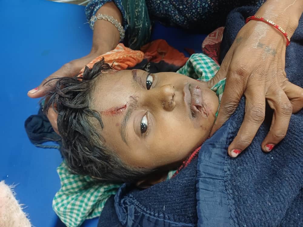 A child was attacked by a pack of dogs, suffering from over 30 wounds.
