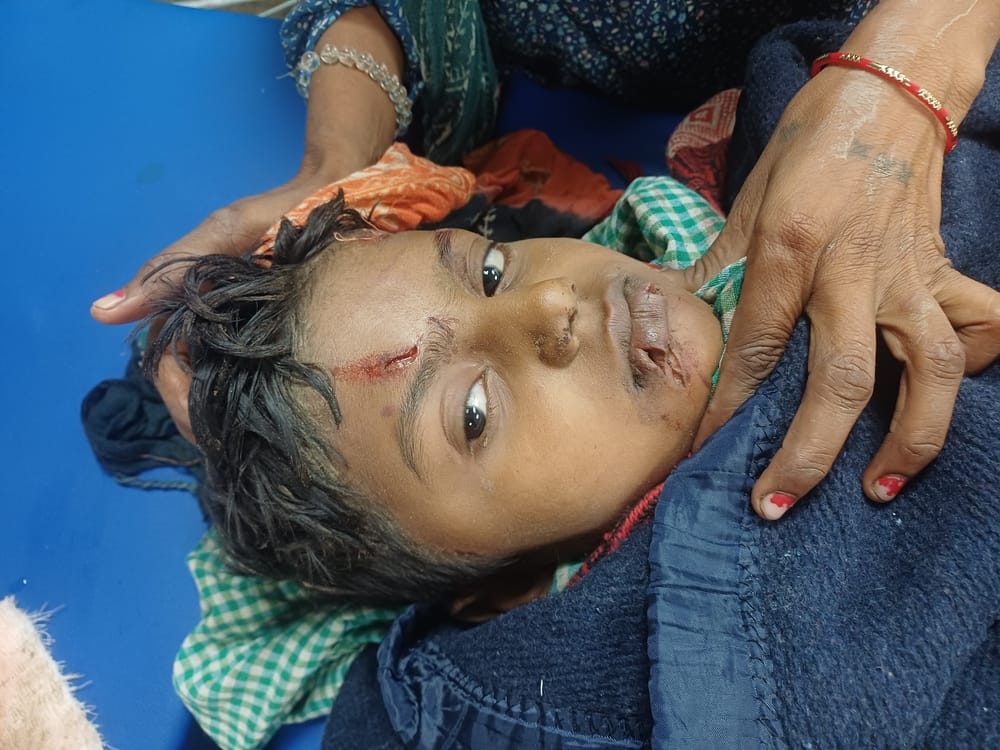 A child was attacked by a pack of dogs, suffering from over 30 wounds.