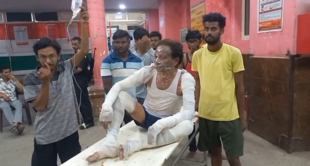 Firozabad News: गैस सिलिंडर लीकेज से लगी आग, जलकल विभाग का नलकूप ऑपरेटर झुलसा
