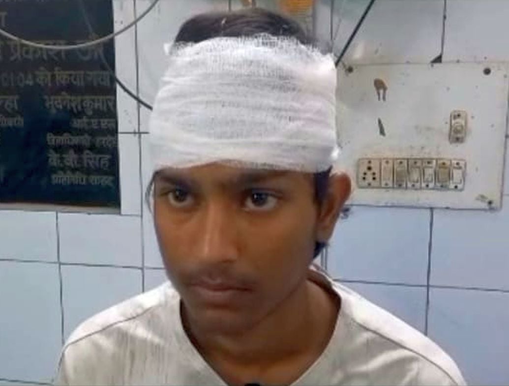 Hardoi News: पुलिस चौकी के पास हॉर्न बजाने के विवाद में भाजपा नेता के बेटे पर हमला