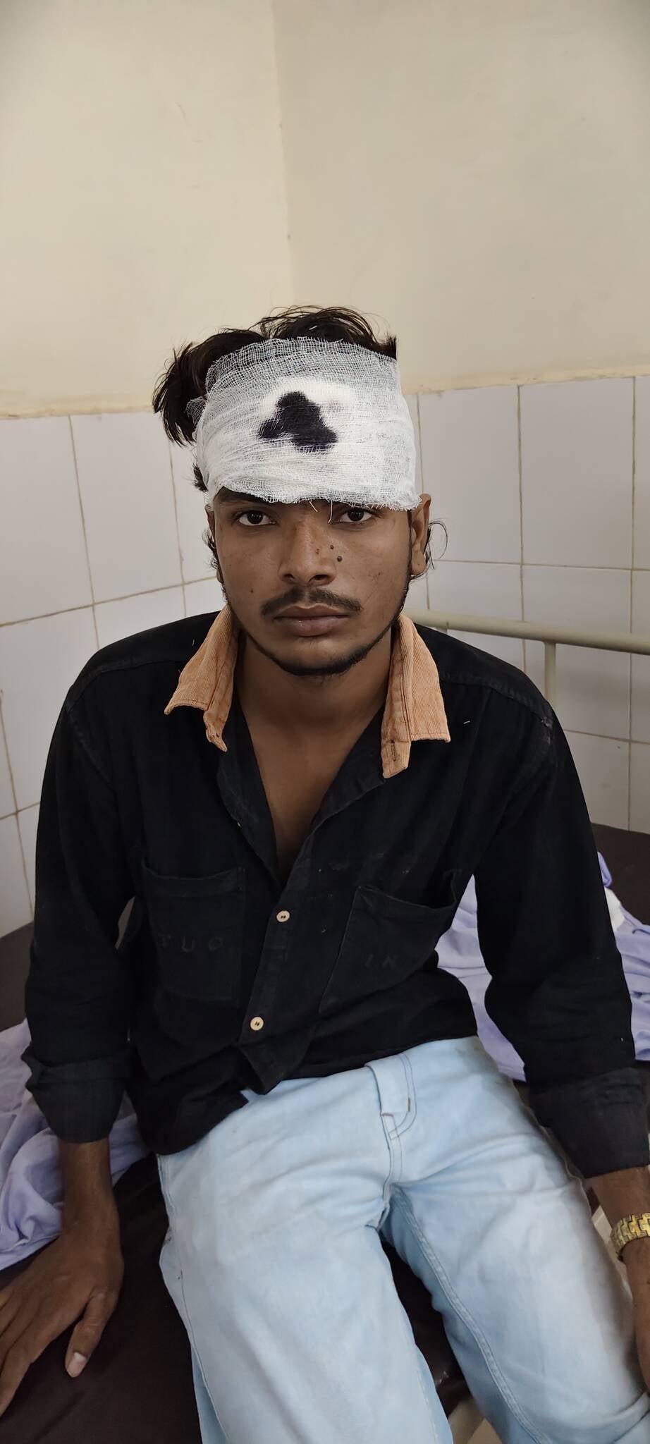 Agra News: ड्रम व डिवाइडर से टकराई बाइक, मां-बेटा घायल