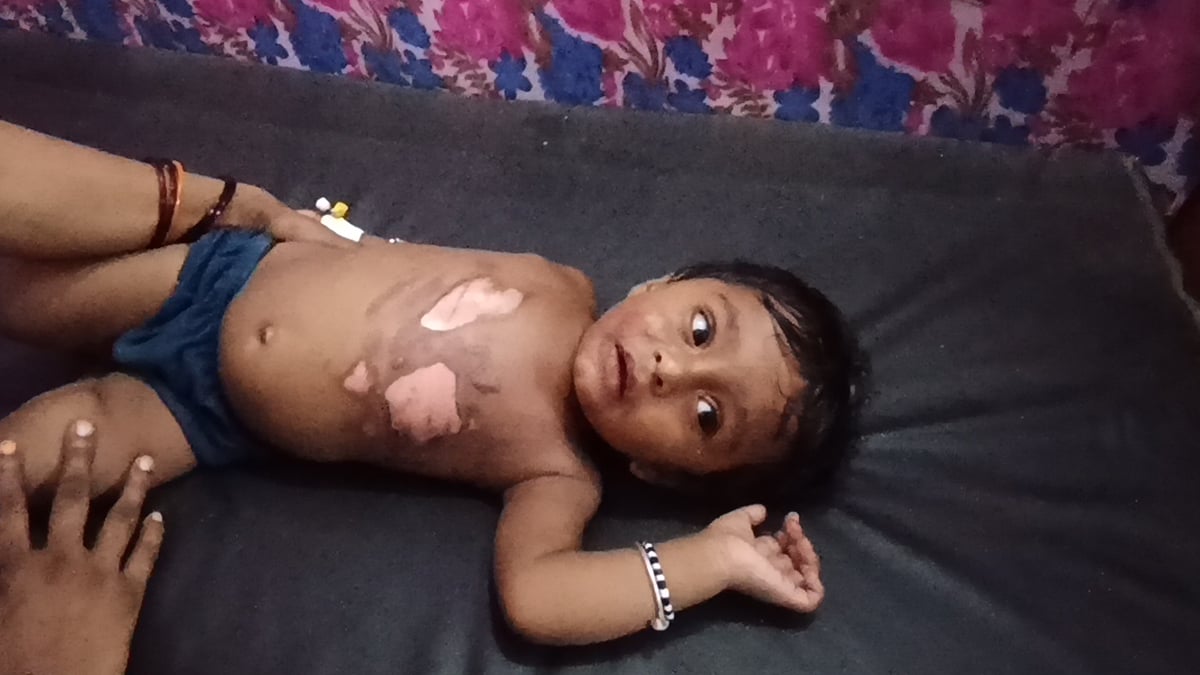 Shravasti News: मामूली विवाद में बच्चे पर फेंका गर्म दूध