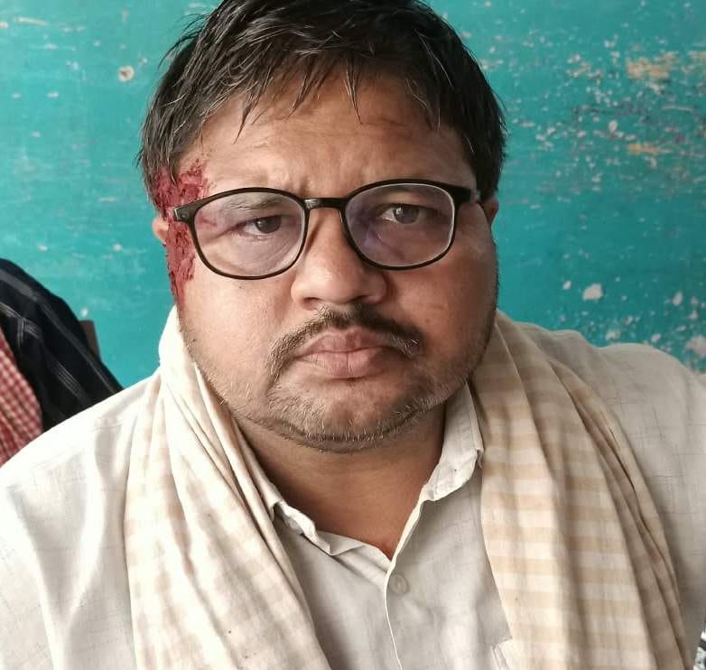 सर पर लगी चोट को दिखाता व्यापारी रतन बरनवाल। संवाद