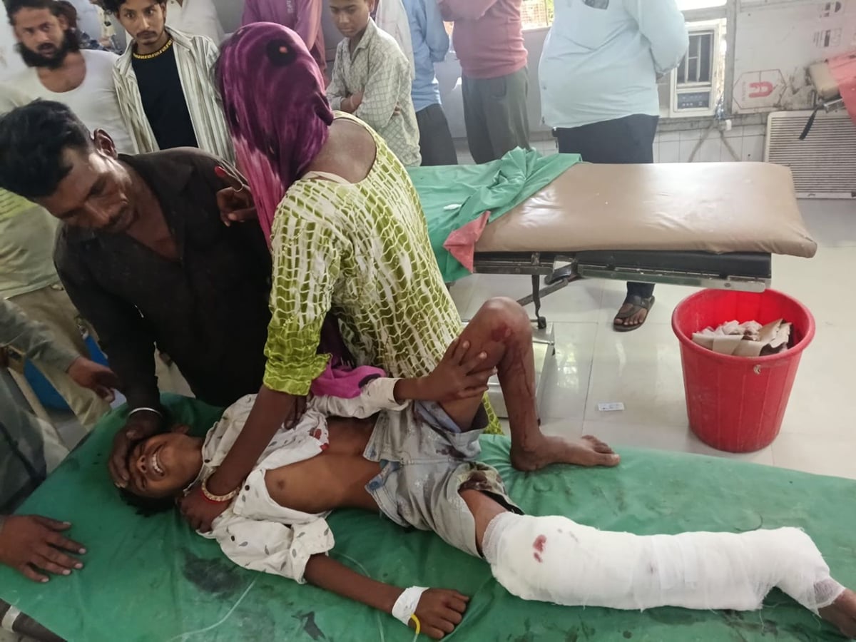 Mahoba News: डंपर बैक करते समय चपेट में आया बालक, पैर कुचला