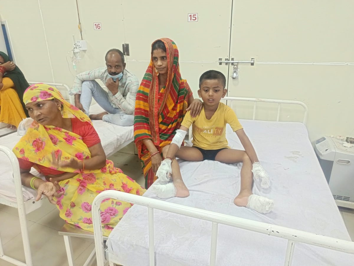 Firozabad News: सरिया से गेंद उतारते समय हाईटेंशन लाइन की चपेट में आया 8 साल का मासूम, झुलसा