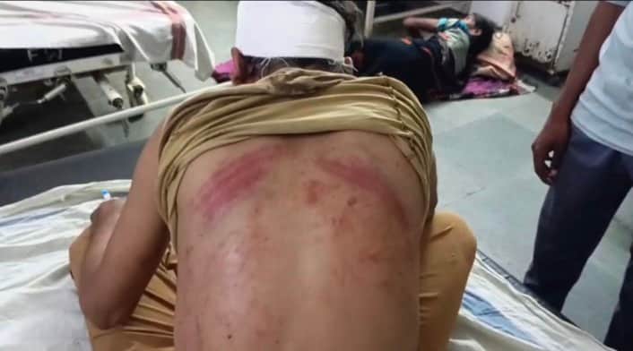 Umaria: Auto Driver Attacked with Sticks and Rods Over Passenger Dispute, Case Registered Against Three