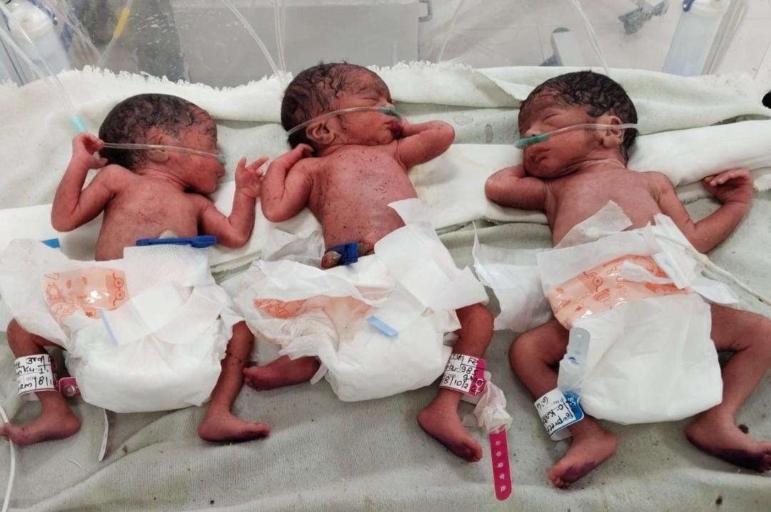 Shahdol: Woman Delivers Triplets Through Normal Delivery, Two Girls and a Boy Born Within 10 Minutes